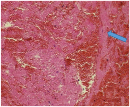 Figure 4. A view of the heart in the group receiving doxorubicin.