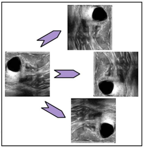 Figure 3.  Visual sample images of data augmentation using three mathematical equations.