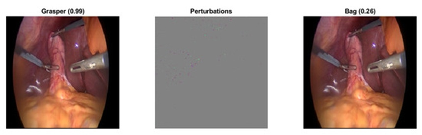 Figure 10. A non-targeted adversarial attack executed against a Grasper image (class 1) utilizing the i-FGSM framework (with a primary step size of 1 and the 6th trigonometric function regulating step reduction), where updates are confined to the top 100 highest-gradient pixels per iteration. The final adversarial pattern demonstrates that altering only 1.2% of the image canvas is sufficient to trigger a classification shift.