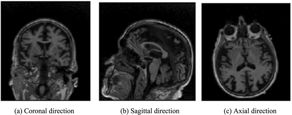 Figure 3. Magnetic resonance imaging (MRI) image example.