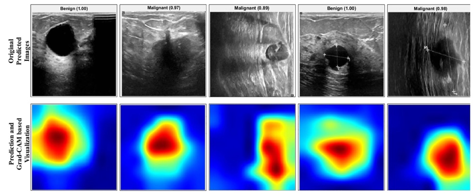 Figure 13.  Labelled prediction and Grad-CAM based visualisation of important region.