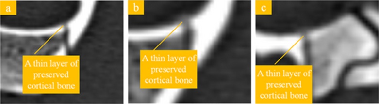 Figure 10. CT sections of the partially unpenetrated pig spine.