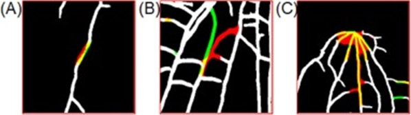 Fig. 9. Illustrative failure cases of our approach. White pixels mark the root in the input; red pixels mark erroneously predicted root; yellow pixels mark correctly predicted root; green pixels mark ground-truth root that the model missed. (For interpretation of the references to color in this figure legend, the reader is referred to the web version of this article.)