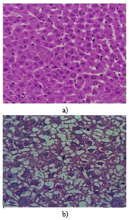 Figure 1. The impact of malathion on liver tissue observed under 4x magnification, stained with hematoxylin-eosin: (a) Liver tissue from the control group showing normal structure; (b) Presence of fat accumulation in liver cell cytoplasm and nuclear pyknosis in liver cells due to malathion exposure.