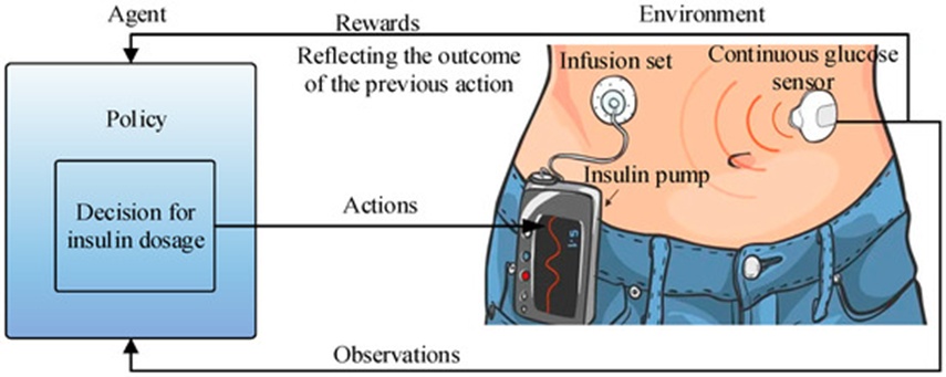 Figure 4. DRL-based AIDs.