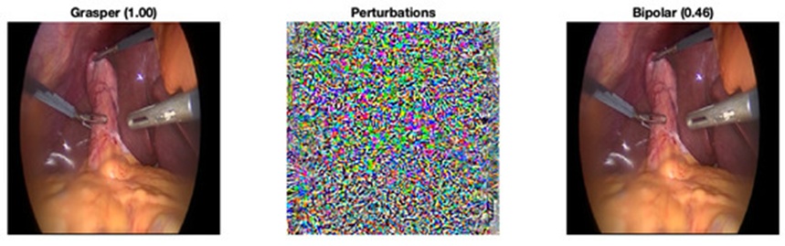 Figure 2. Modify an image from Grasper (class 1) to Bipolar (class 2) with the fast gradient sign method (FGSM). The adversary (right) with minimal perturbation was generated exactly when the classification changed.
