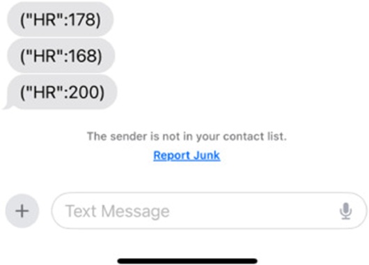 Figure 10. A screen capture illustrating the instantiation of an IoT rule that promulgates an alert communiqué to the operator consequent to HR readings surpassing the predefined threshold marker of 150 [48].