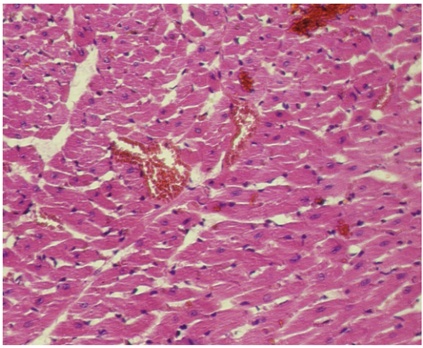 Figure 2. A view of the heart in the DMSO group.