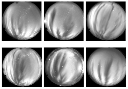 Figure 2. Visual examples of the detected EPBs.