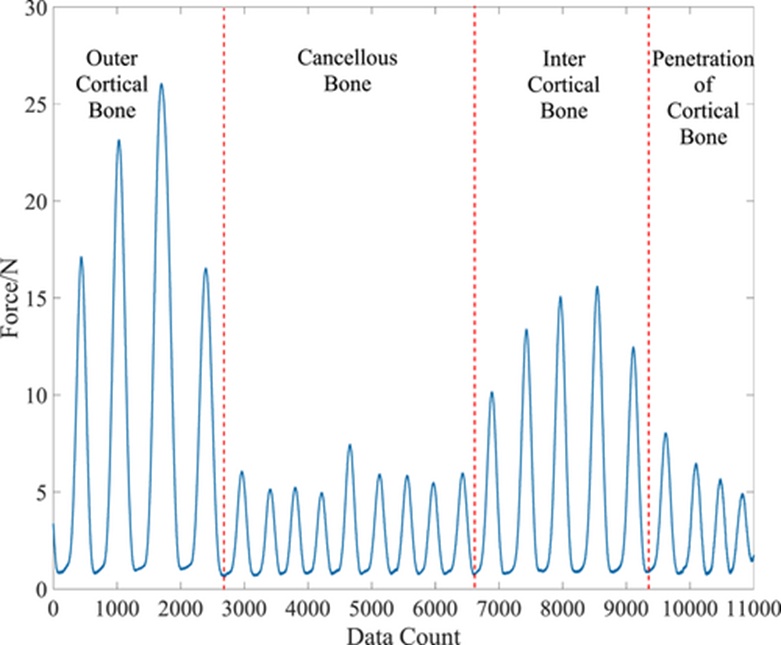 Figure 1. Cutting force of cortical bone and cancellous bone in ultrasound surgery.