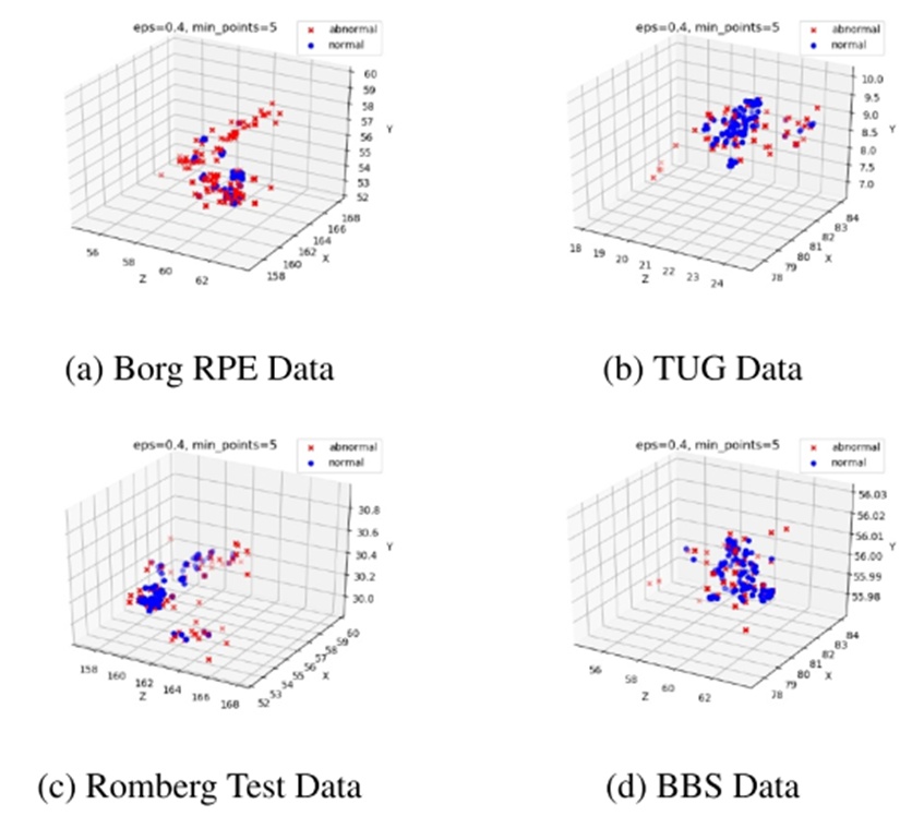 Figure 7. Visualisation of abnormal detection of density-based spatial clustering of applications with noise with reference paper parameters. BBS, Berg Balance Scale.