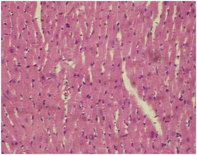 Figure 3. A view of the heart in the quercetin group.