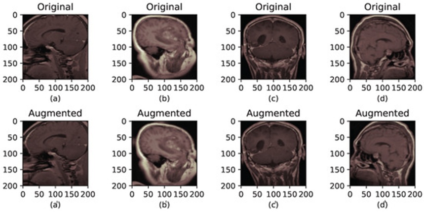 Figure 5. The brain tumor MRI before and after augmentation. (a–d) correspond to the original images, while (a′–d′) correspond to their augmented versions.