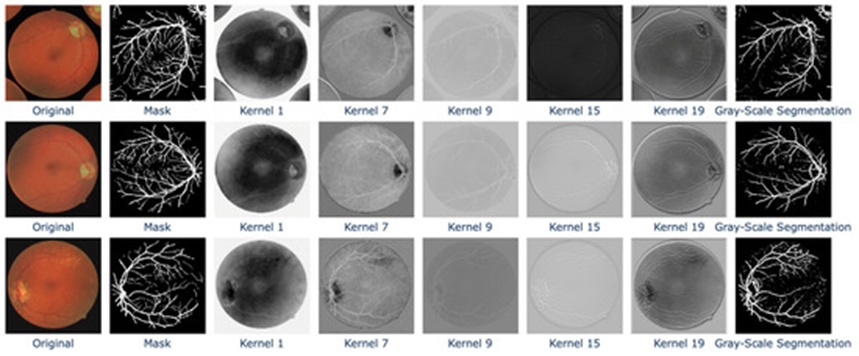 Figure 3. Transformations of the most important kernels on the original image. The mask serves as the ground truth, while the grayscale segmentation represents the model’s output. Visual outputs from the most important layers—1, 7, 9, 15, and 19—are displayed. These outputs help to clarify the final decisions made by the ExShall-CNN model.