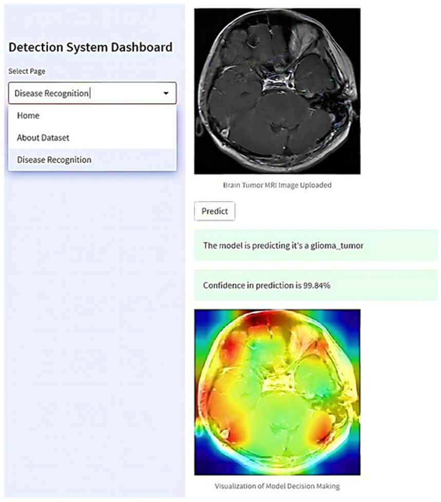 Figure 19. The proposed web-based interactive application for real-world brain tumor detection.