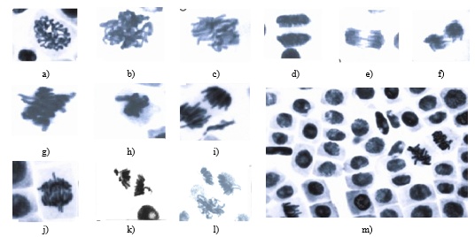Figure 4. Microscopic depictions of mitotic progression within plant cells are shown, including (a and b) typical prophase, (c) standard prometaphase, and (d) conventional telophase, captured following exposure to varying levels of ZnSO₄; images (e and f) illustrate distorted anaphase with evident chromosomal bridges observed at 50 ppm, while (g) depicts prematurely aligned chromosomes during metaphase at 20 ppm. Further, panels (h and i) present metaphase and anaphase chromosomes appearing prematurely aligned at 20 ppm; in (j), anaphase is marked by the presence of spherical chromosomal configurations alongside precociously progressing chromosomes at 50 ppm; (k and l) exhibit anaphase figures with accelerated chromosomal movements, and (m) provides an overall microscopic field overview.