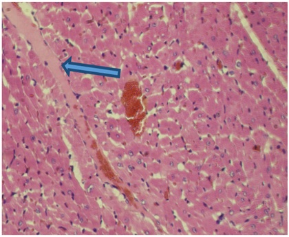 Figure 5. A view of the heart in the group receiving doxorubicin plus quercetin.