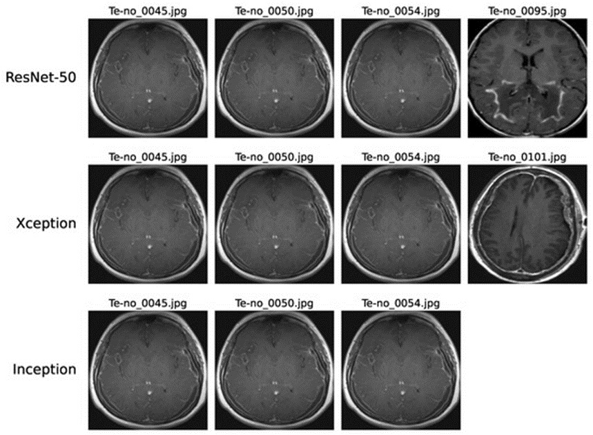 Figure 9. Instances of no-tumor images misdiagnosed as Glioma on ResNet-50, Xception, and InceptionV3 models.