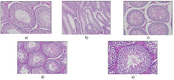 Figure 4. The impact of CCl₄ and ART on testicular histology is shown: (a) testicular sections from the control group display intact seminiferous tubules and normal epithelial lining, (b) testes from the CCl₄-treated group exhibit disrupted membranes and distorted seminiferous tubules, (c) testes from the ART-only group maintain normal histoarchitecture, and (d–e) testes from the group treated with both CCl₄ and ART show near-normal structure, with restored epithelial height and visible spermatogonia.