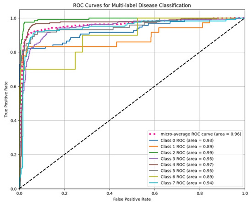 Figure 10. ROC curves for the ViT-based multi-label classification model, illustrating per-class AUC and micro-average performance (AUC = 0.96).