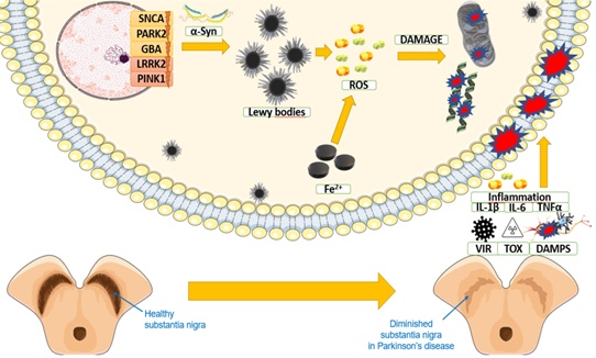 Figure 1. The complex molecular mechanisms involved in PD include genetic factors (e.g., SNCA, PARK2, LRRK2, PINK1, GBA), inflammatory cytokines (IL-1β, IL-6, TNFα), environmental toxins, and oxidative stress (ROS), all of which contribute to disease progression.
