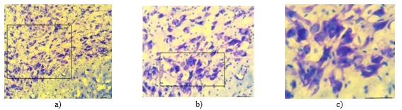 Figure 3. Nissl staining of hippocampal neurons from the rotenone group. Scale bar: A-C 100 µm.